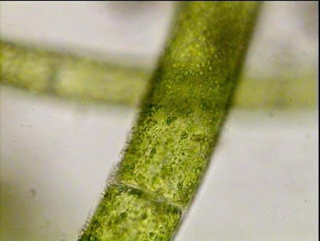 alga cladophora x400